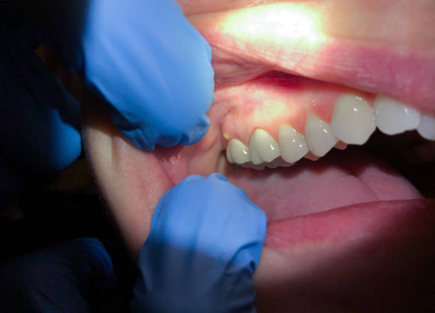 Best Broken or Chipped Tooth Repair in Maine, WI